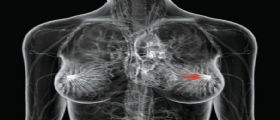 Il cancro si cura con il bicarbonato di sodio?