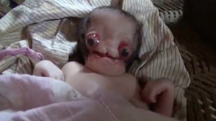 The newborn baby boy, who hasn’t been named yet, is otherwise healthy The newborn baby boy, who hasn’t been named yet, is otherwise healthy
