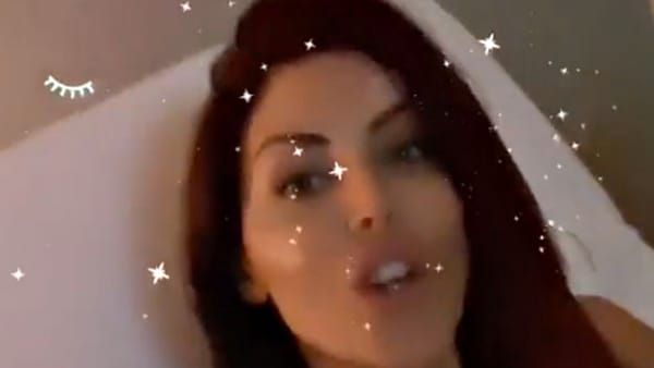Problemi al decoltè! Guendalina Tavassi in clinica per un’intervento di chirurgia estetica