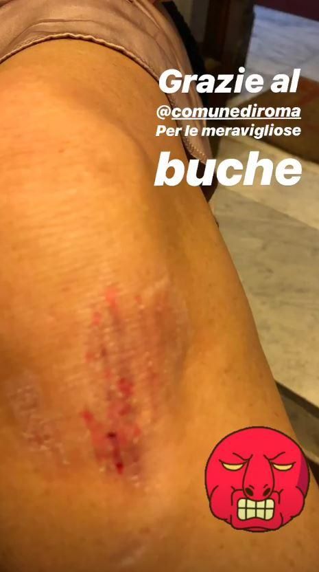 Grazie Roma! La Perego cade nella buca e si fa male