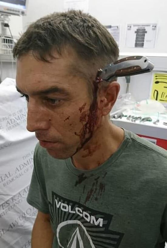 C'è un dottore libero?... va in ospedale con un coltello in testa