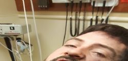 A Andrew Hall esplode la sigaretta elettronica : sette denti rotti e ustioni di secondo grado